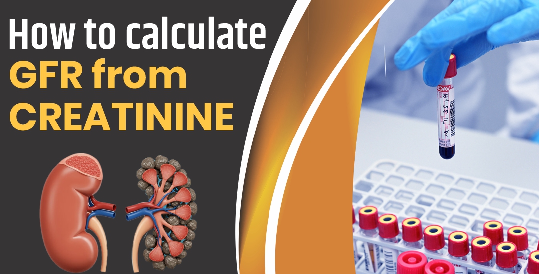 How to Calculate GFR from Creatinine?